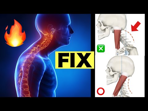 Видео: Получить хорошую осанку✨Как исправить горб на шее и худое лицо