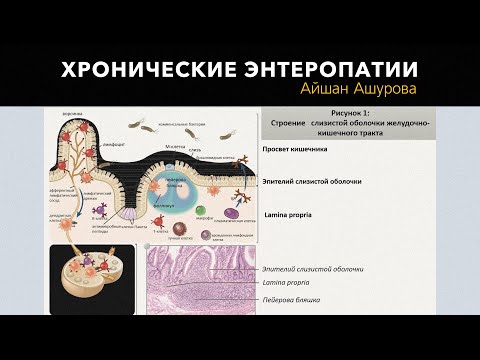 Видео: Хронические энтеропатии