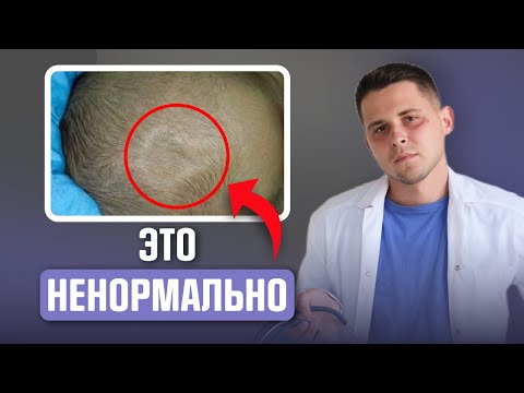 Видео: РОДНИЧОК У НОВОРОЖДЕННОГО, обрати внимание на эти сигналы, пока не стало поздно