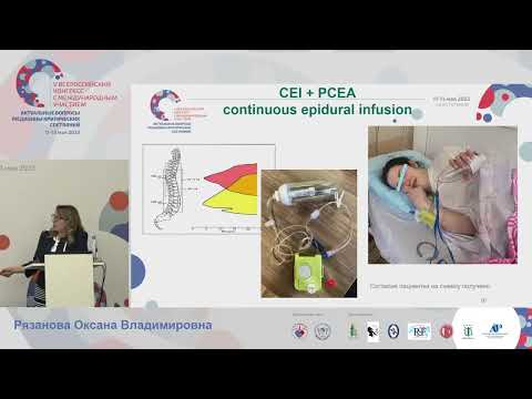 Видео: Обезболивание родов Рязанова О.В.