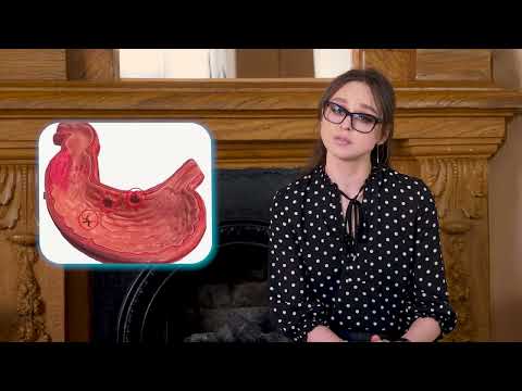 Видео: Признаки язвенной болезни желудка | ГЦМП