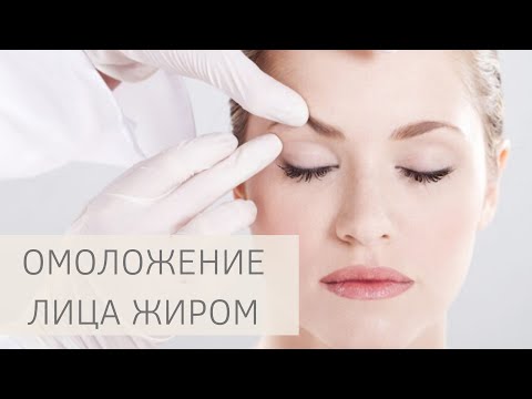 Видео: ЛИПОФИЛИНГ ЛИЦА | Омоложение ЖИРОМ