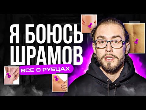 Видео: СТРАШНЫЕ РУБЦЫ И ШРАМЫ I КАК ФОРМИРУЮТСЯ РУБЦЫ И КАК ПРАВИЛЬНО СШИВАТЬ ТКАНИ