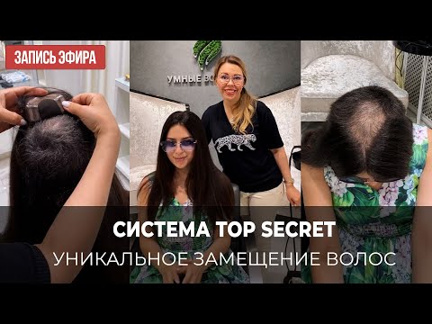 Видео: Система замещения волос Top Secret