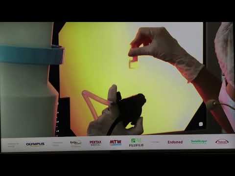 Видео: 46 Live Коржева ИЮ Бронхоскопия rEBUS TBBL криобиопсия