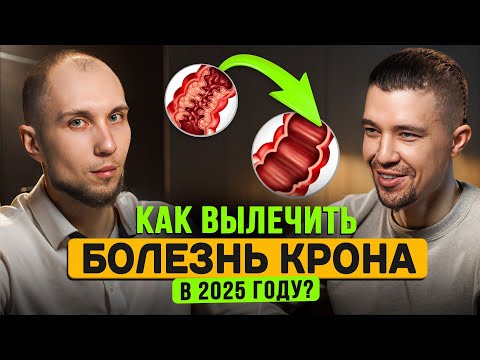 Видео: Формула выздоровления от болезни крона | Диета, психология, спорт при взк