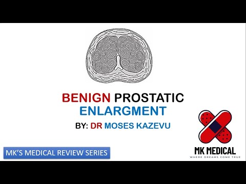 Видео: Доброкачественное увеличение предстательной железы || ДГПЖ || ДГПЖ