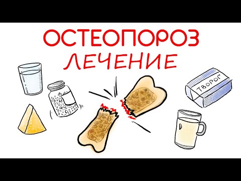 Видео: Остеопороз: как правильно лечить // Доктор Ху