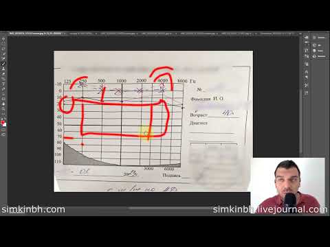 Видео: Забавно точные замеры без тугоухости