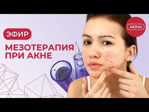 Видео: Мезотерапия при акне