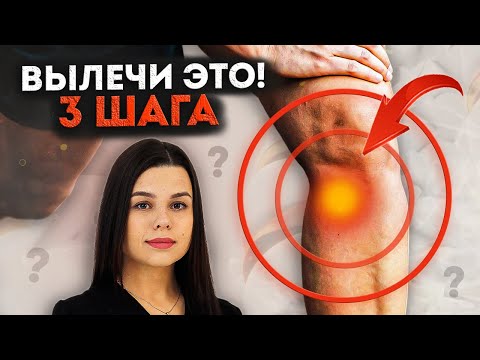 Видео: Эту боль ПРОПУСКАЮТ чаще всего! Как ВЫЛЕЧИТЬ боль в колене?  Гусиная лапка