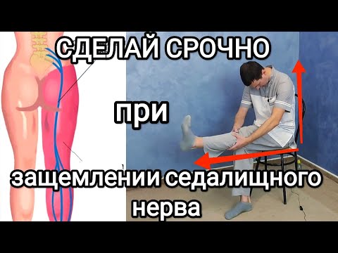 Видео: Защемление седалищного нерва! Сделай СРОЧНО и станет гораздо легче!
