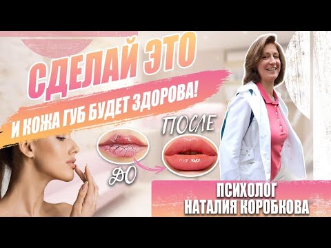 Видео: Сохнут губы, трескаются, облазят. Что делать.