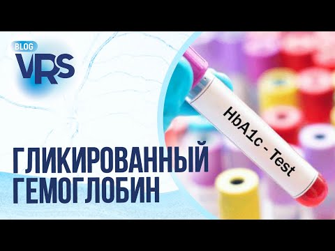 Видео: Сахарный диабет / Диабетическая ретинопатия / Гликированный гемоглобин