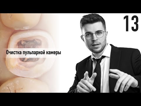 Видео: Уроки эндодонтии. Очистка пульпарной камеры