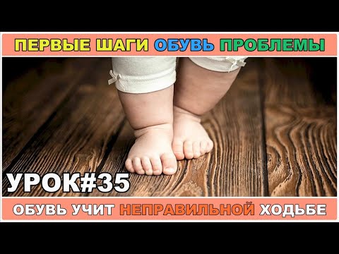 Видео: НЕПРАВИЛЬНАЯ #ПОХОДКА В ОБУВИ #ХОДЬБА. УРОК35.