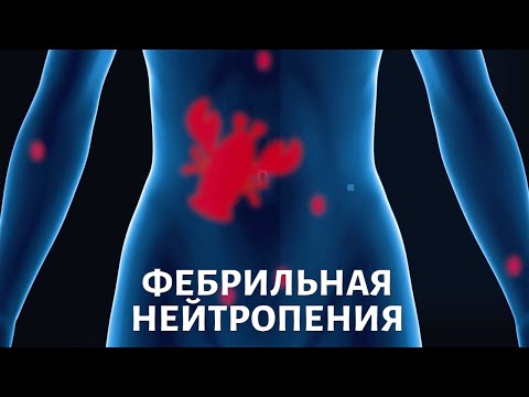 Видео: Осложнения во время химиотерапии. Почему возникает фебрильная нейтропения?