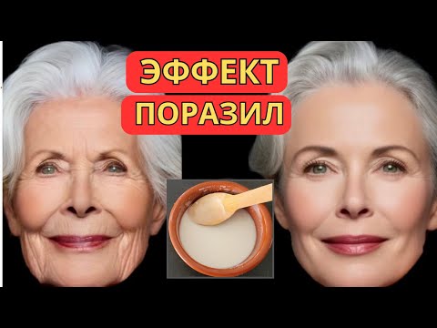 Видео: Она УМЫВАЕТСЯ ЭТИМ ! ЧИСТАЯ КОЖА за КОПЕЙКИ  сода + Мёд - ЛУЧШАЯ умывалка.