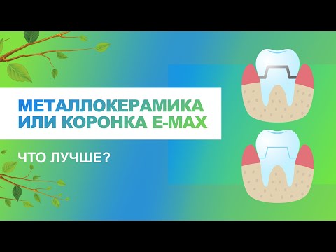 Видео: 📌 Металлокерамика или коронка e-max, какие материалы лучше?