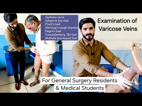 Видео: Обследование варикозного расширения вен — доктор Тайяб Риаз Ч.