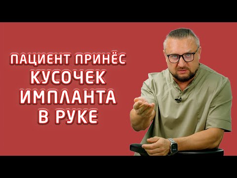 Видео: ИМПЛАНТЫ ОТТОРГАЮТСЯ и ВЫПАДАЮТ чаще всего по этим причинам!