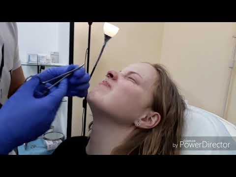 Видео: VLOG: ПРОКАЛЫВАЕМ НОС||СЕПТУМ||УХОД||БОЛЬНО ЛИ?