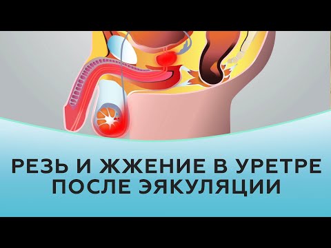 Видео: Резь в уретре после эякуляции