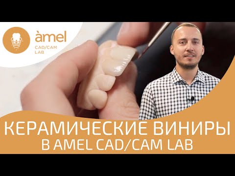 Видео: Изготовление керамических винир в Bauers CAD / CAM Lab
