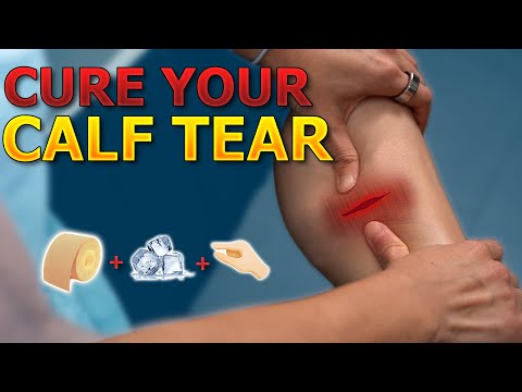 Видео: У вас порвана икра? (Тестирование, тейпирование и другие советы)