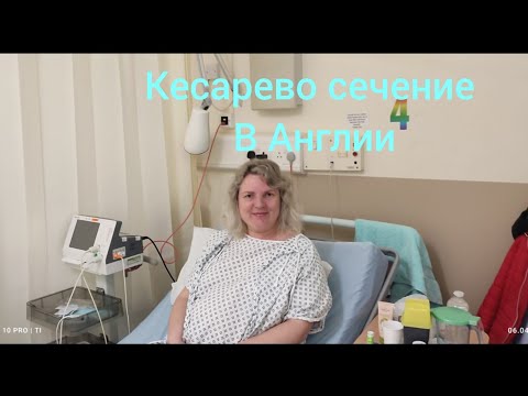 Видео: Кесарево сечение как проходит в Англии? Мой личный опыт в Великобритании. Стоит ли бояться кесарева?