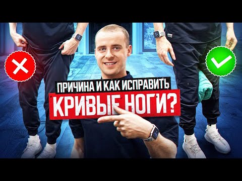 Видео: Кривые ноги ? Причина и как исправить этот недуг ? Ноги Анжелины Джолли.