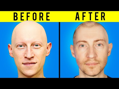 Видео: Как мне удалось вернуть волосы...