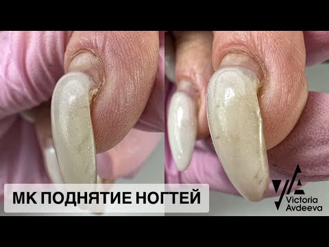 Видео: ПОДНЯТИЕ НОГТЕЙ. Виктория Авдеева