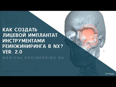 Видео: Как создать лицевой имплантат инструментами реинжиниринга в NX? | Medical engineering NX. Ver. 2.0