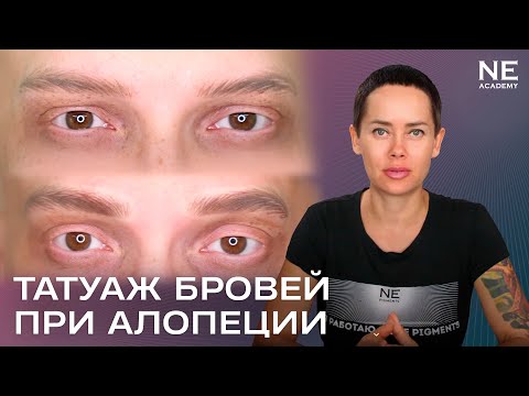 Видео: Алексей. #Татуаж бровей при алопеции