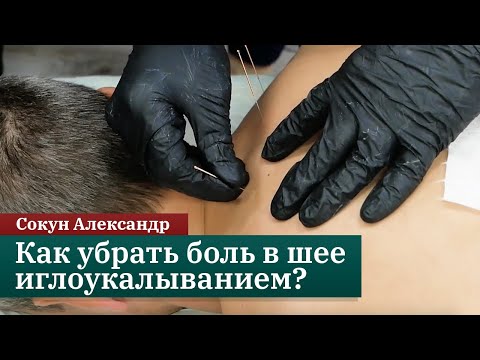 Видео: Как убрать боль в шее методом сухой иглы? Сокун Александр