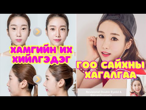 Видео: Солонгын орноор | 2024-09-24 | Гоо сайхны хагалгаа