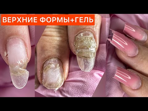 Видео: КОРРЕКЦИЯ НАРАЩИВАНИЯ ТИПСАМИ🤢ВЕРХНИЕ ФОРМЫ