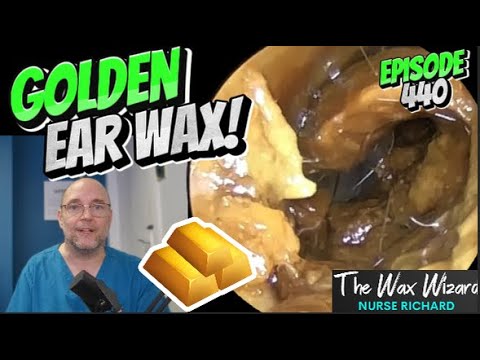 Видео: ЗОЛОТАЯ УШНАЯ СЕРА! Эпизод 440 (и «златовласка», и самые крошечные ушки!)
