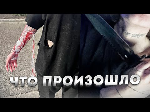 Видео: Курсед рассказал, как его пырнули ножом на улице