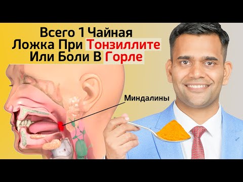 Видео: ЛЕЧЕНИЕ ТОНЗИЛЛИТА И БОЛИ В ГОРЛЕ.