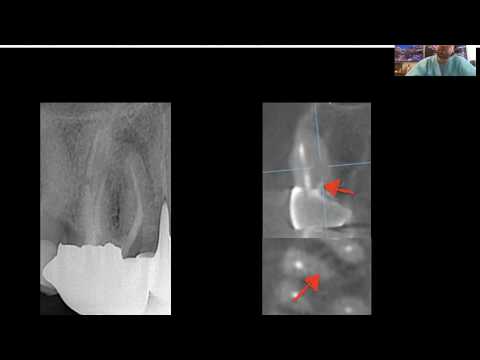 Видео: Разбор клинического случая