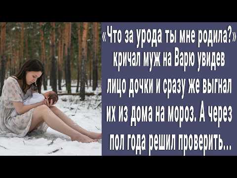 Видео: Что за монстра ты мне родила?! кричал муж увидев лицо малышки и выгнал жену из дома. А через полгода