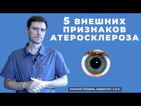 Видео: 5 ВНЕШНИХ ПРИЗНАКОВ АТЕРОСКЛЕРОЗА #5признаковатеросклероза #атеросклероз #ДокторАлексейЛазарев