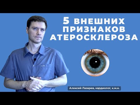 Видео: 5 ВНЕШНИХ ПРИЗНАКОВ АТЕРОСКЛЕРОЗА #5признаковатеросклероза #атеросклероз #ДокторАлексейЛазарев