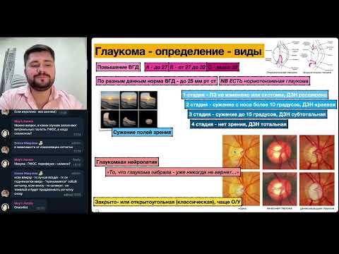 Видео: Глаукома - демо превью-видео из нашего курса Фундаментальная офтальмология