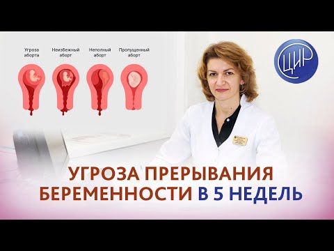 Видео: Угроза прерывания беременности в 5 недель, мутация Лейдена, клексан и транексам.