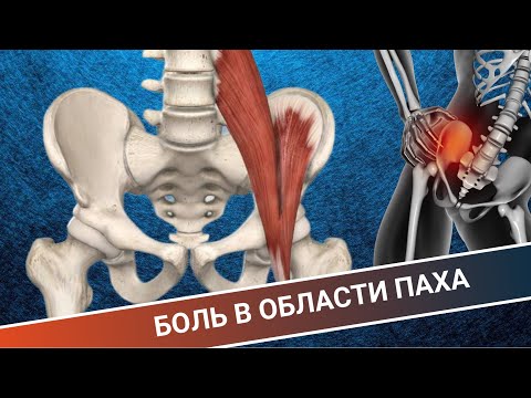 Видео: БОЛЬ В ОБЛАСТИ ПАХА. ГЛАВНЫЕ ПРИЧИНЫ