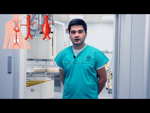 Видео: ЧТО ТАКОЕ АНЕВРИЗМА АОРТЫ?