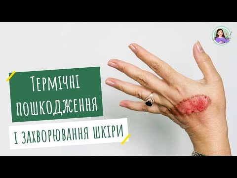 Видео: Термічні пошкодження і захворювання шкіри